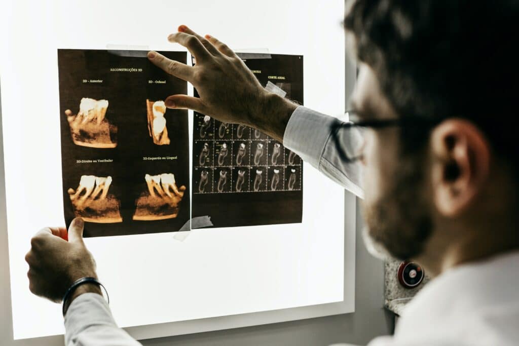 X-ray dentist picture for ExpressDentist – https://expressdentist.com/oral-surgeon/