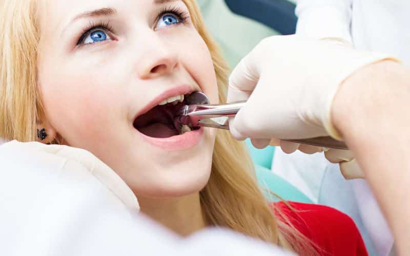 women patient dentist remove Erupted Wisdom Tooth