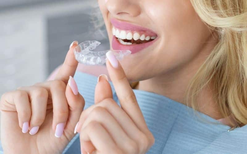 women Use Invisalign With Dental Implants