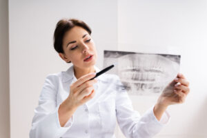 Dental Wisdom Teeth Dental X Ray Imaging