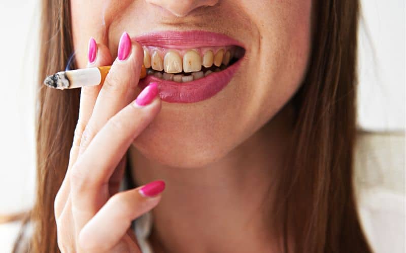 signs of smoking dentist noticeable effects is that it causes teeth to become discoloured