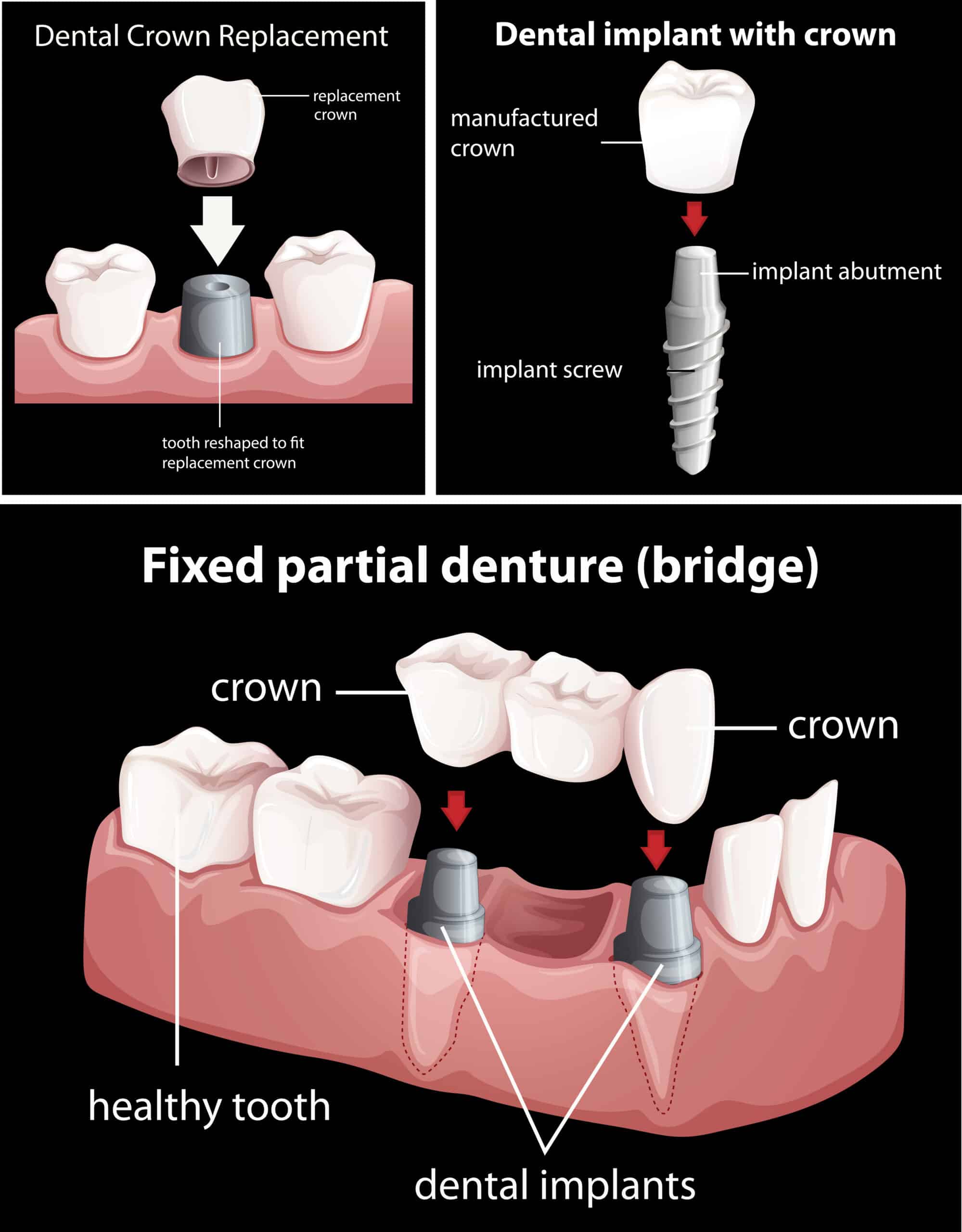 Dental Procedures