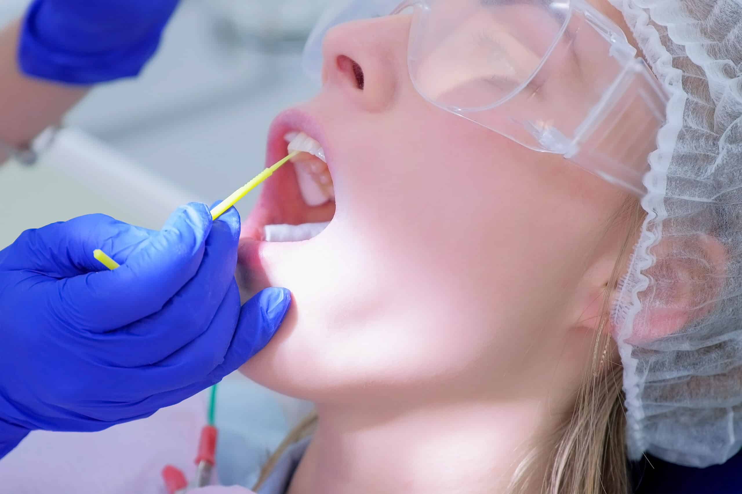 Dentist make fluoridation of teeth after ultrasonic cleaning for young woman