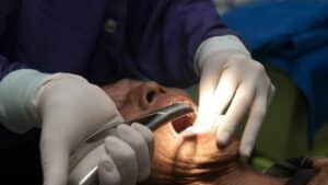 Dentists pull teeth to the patient