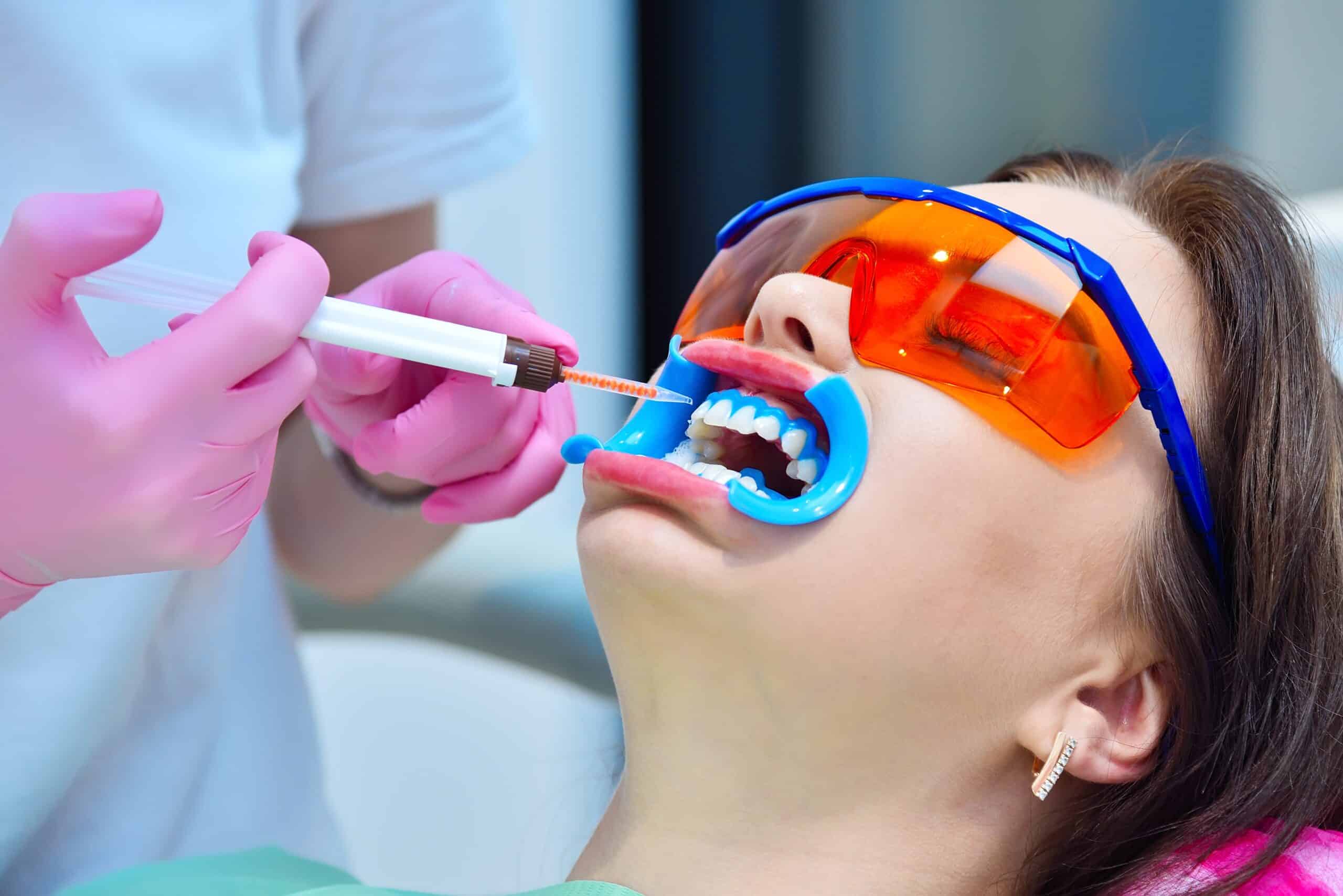Dentist applies whitening gel to woman patient teeth in dental clinic