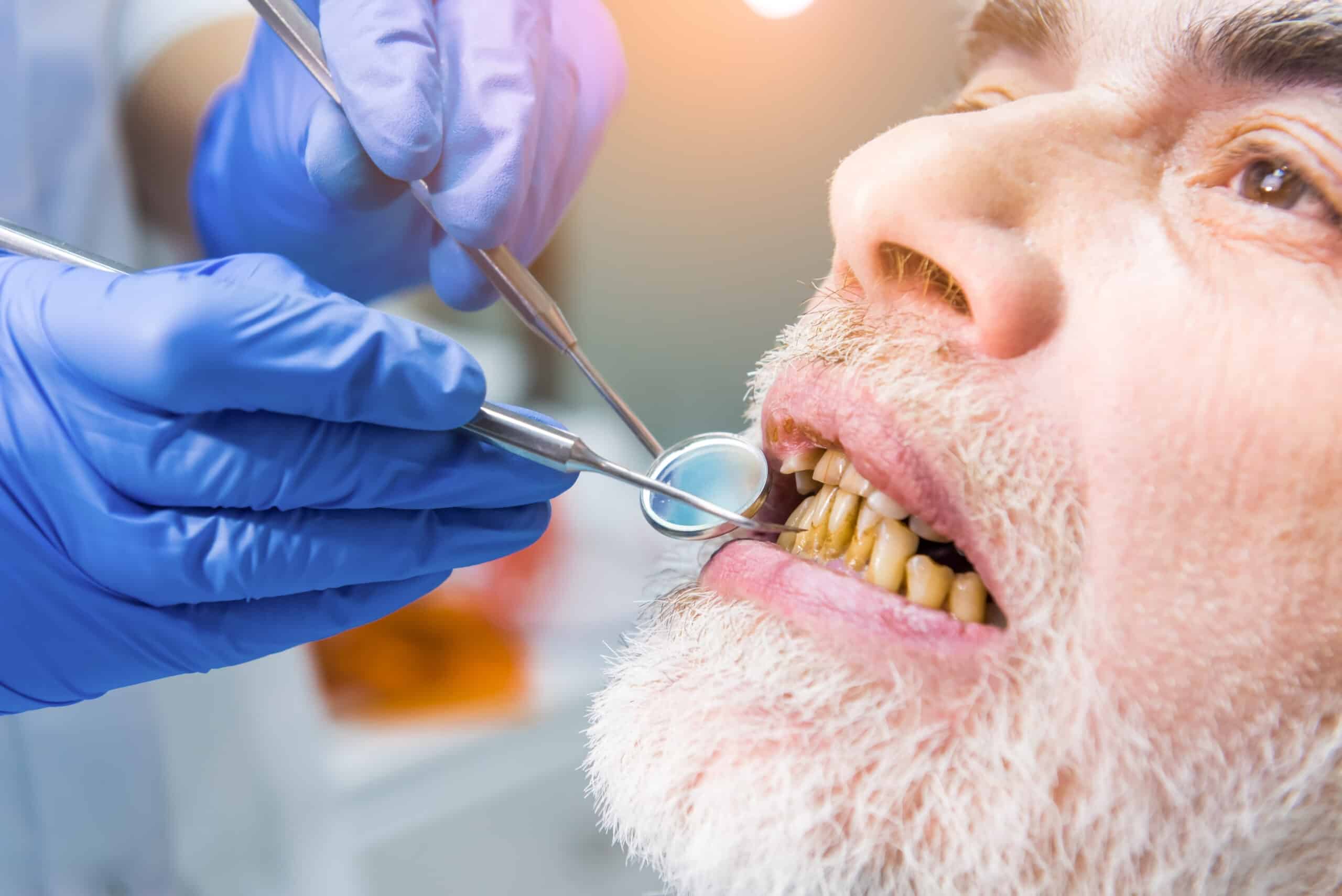 Consequences of Neglecting Oral Health Care
